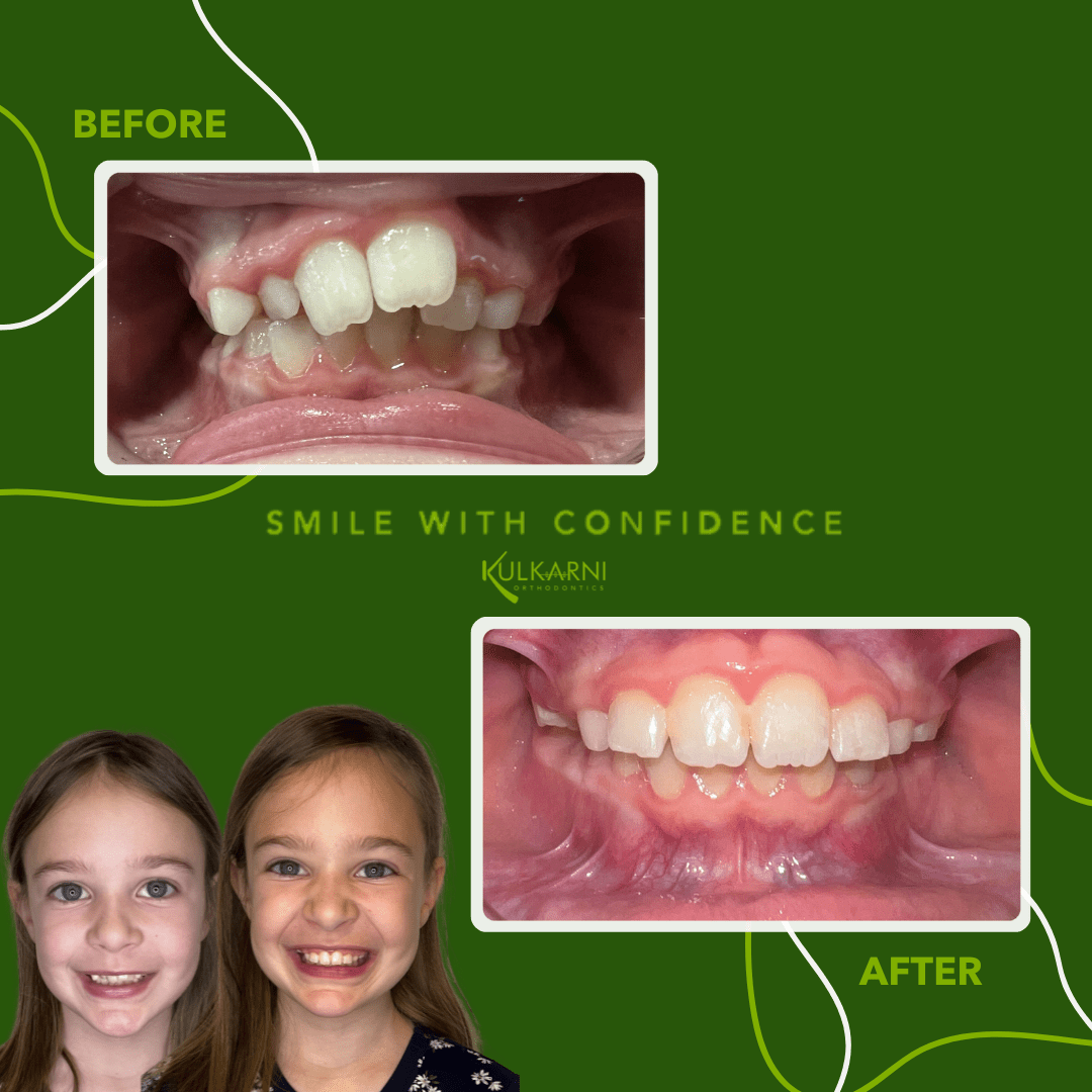 Kulkarni Orthodontics Photo 06