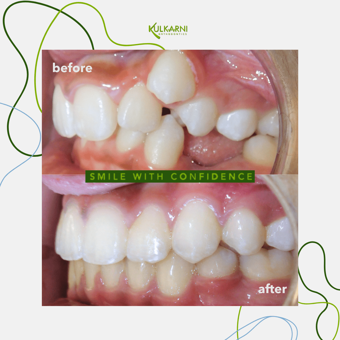 Kulkarni Orthodontics Photo 08