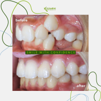 Kulkarni Orthodontics Photo 08